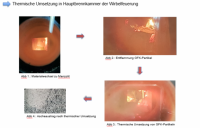 thermischer Umsatz von Glasfaserverbundwerkstoff in Wirbelfeuerung